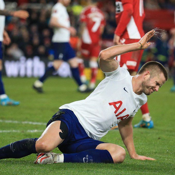 热刺不敌英冠队出局 足总杯爆大冷